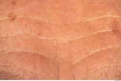 Photo Textures of Human Skin